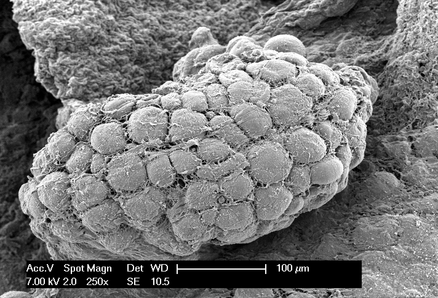 Adipociti - Microscopio Elettronico A Scansione