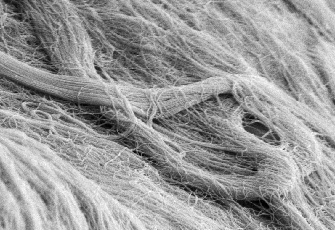 Fibre Collagene - Microscopio Elettronico A Scansione