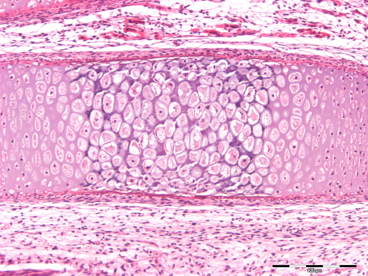 cartilagine di accrescimento - MicroscopiaLuce