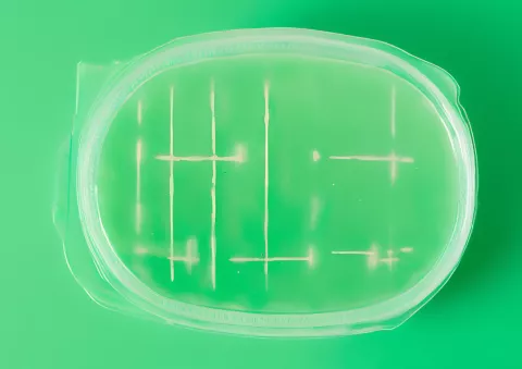 Capsula di Petri