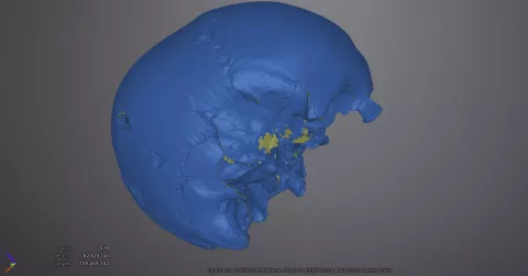 Nuvola di punti di cranio archeologico