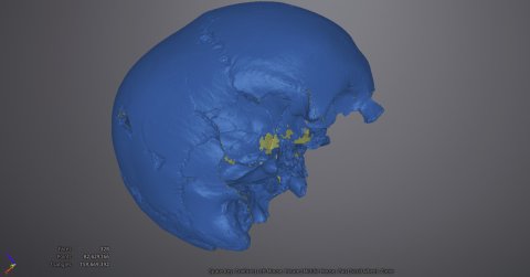 Nuvola di punti di cranio archeologico