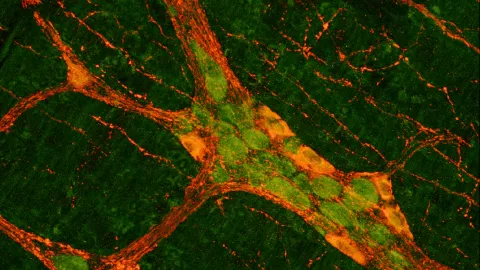 enteric nervous system
