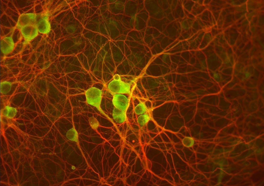 Centro Neuroscienze - Immagine Neuroni cerebellari